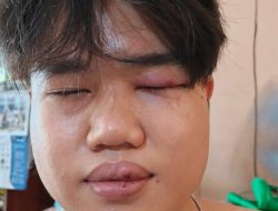 Dikeroyok di Area Kampus, Mahasiswa Universitas Buddhi Dharma Tangerang Buat Laporan Polisi